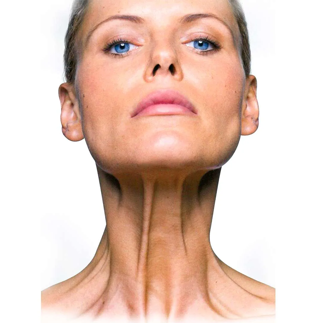 PLATYSMA